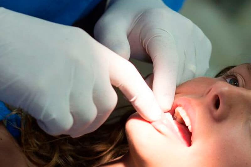 Oral Cancer Screenings